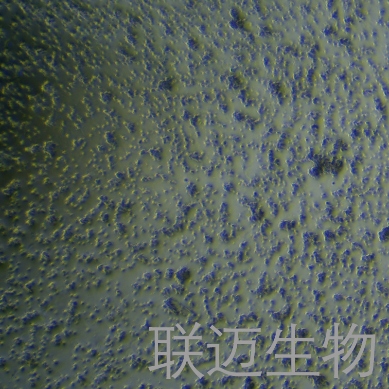 TMD8细胞（弥漫性大B细胞淋巴瘤）LM8C0785