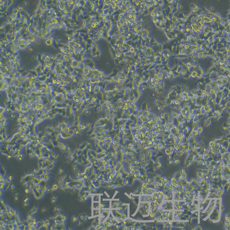 LS 174T [LS174T]细胞（结肠腺癌细胞）LM8C0717