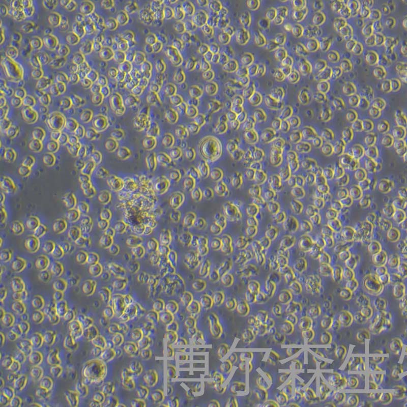 SET-2细胞（成人急性巨核细胞白血病细胞）