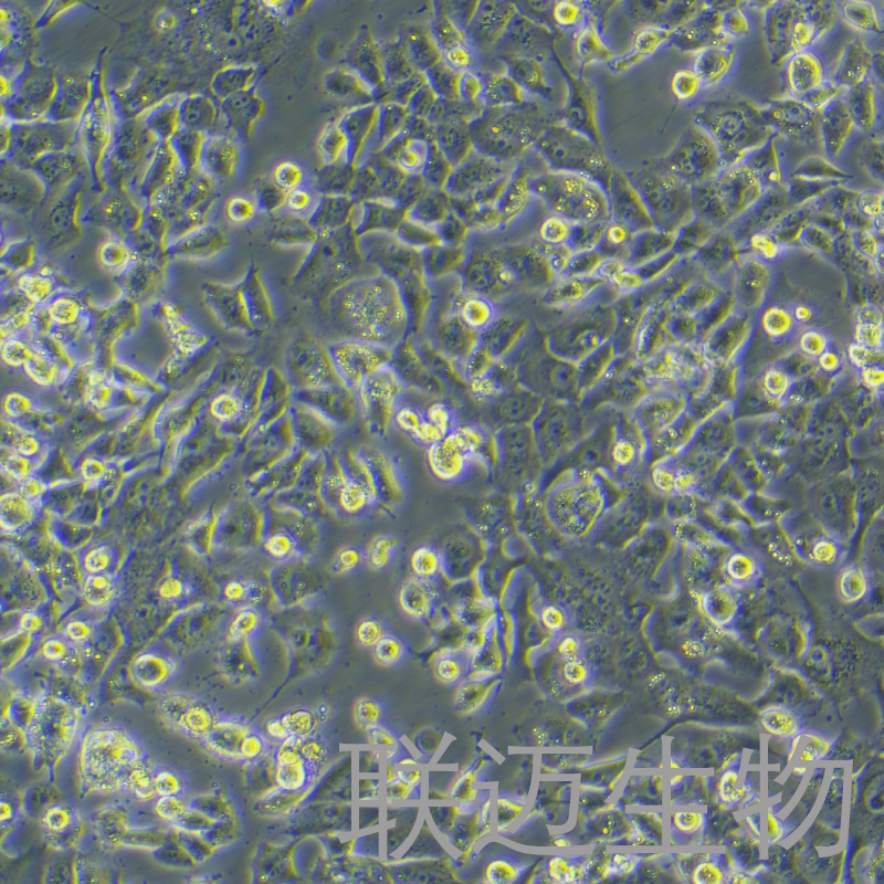 NCI-H1915细胞（非小细胞肺癌细胞）LM8C0744