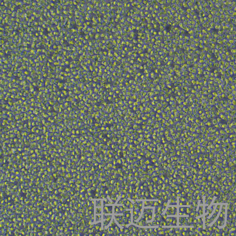 OCI-LY1细胞（B细胞淋巴瘤）LM8C0761