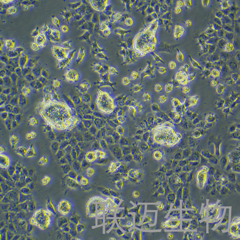 NCI-H508[H508]细胞（结肠直肠腺癌细胞）LM8C0789