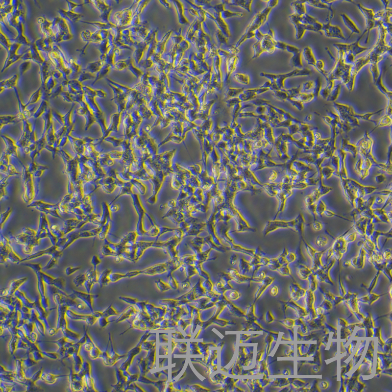 BE(2)-M17细胞（神经母细胞瘤细胞）LM8C0806