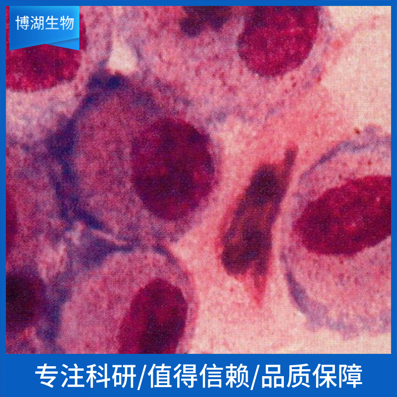 人滤泡状甲状腺癌细胞，肺转移；FTC238