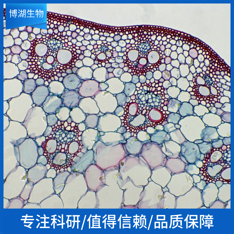 人慢性B细胞白血病细胞；MEC-1 (STR)