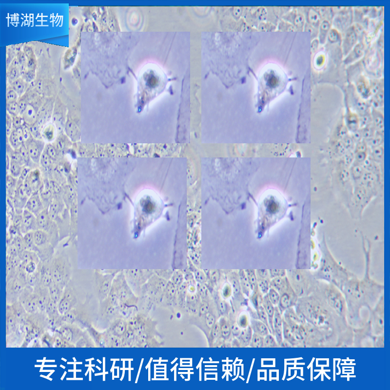 人弥漫大B淋巴瘤细胞；HBL-1