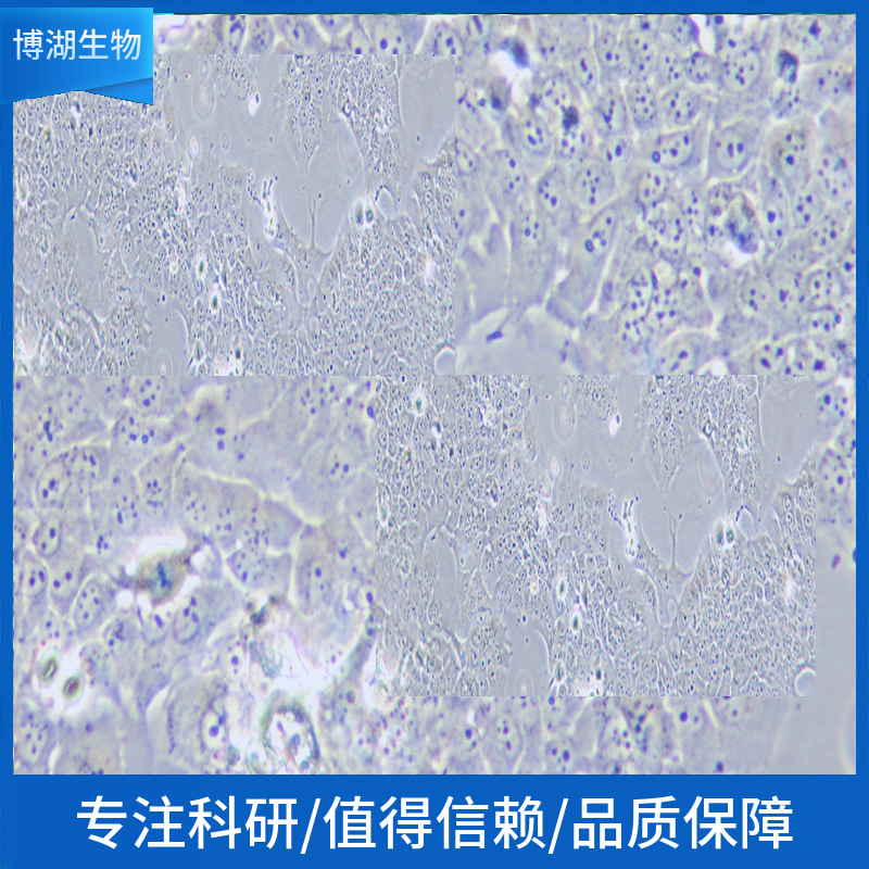 人脑胶质细胞瘤细胞；DBTRG-05MG