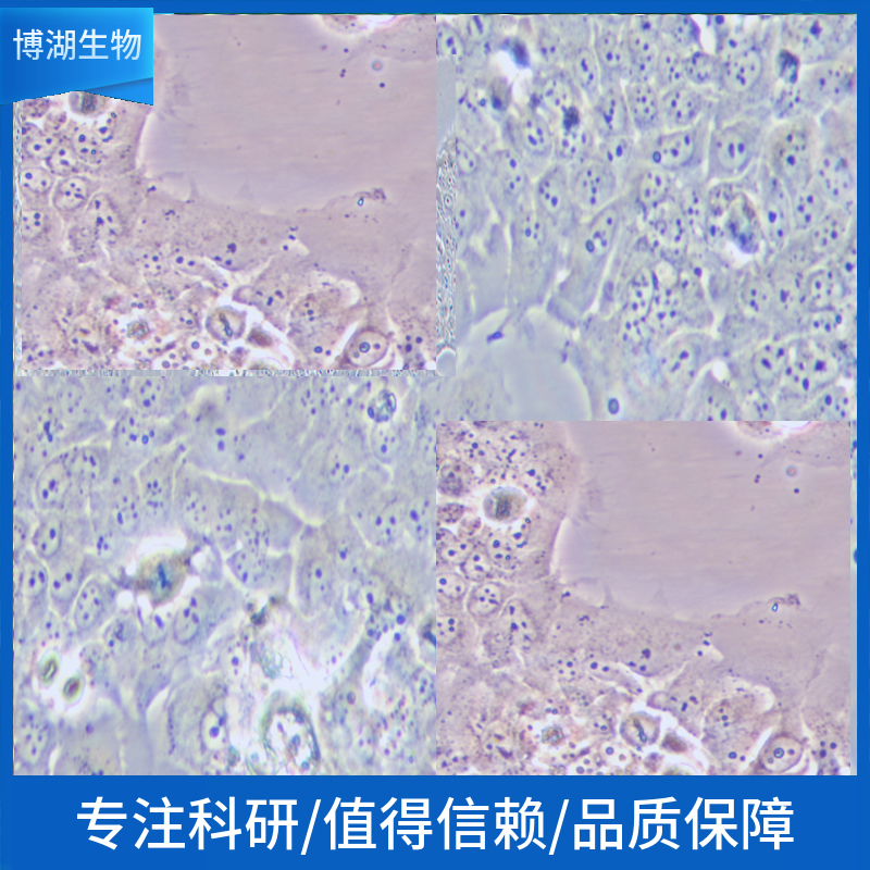 人脑星形胶质母细胞瘤细胞;U87-MG-LUC-EGFP