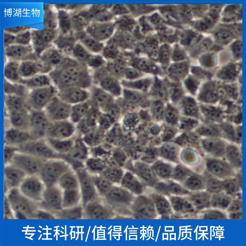 人黑色素瘤细胞；A375.S2 (STR)