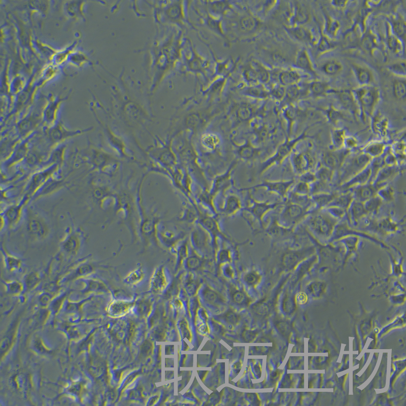 EOMA细胞（小鼠血管内皮瘤细胞）LM8C0835