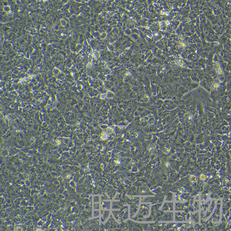 GT1-1细胞（小鼠垂体瘤细胞）LM8C0829