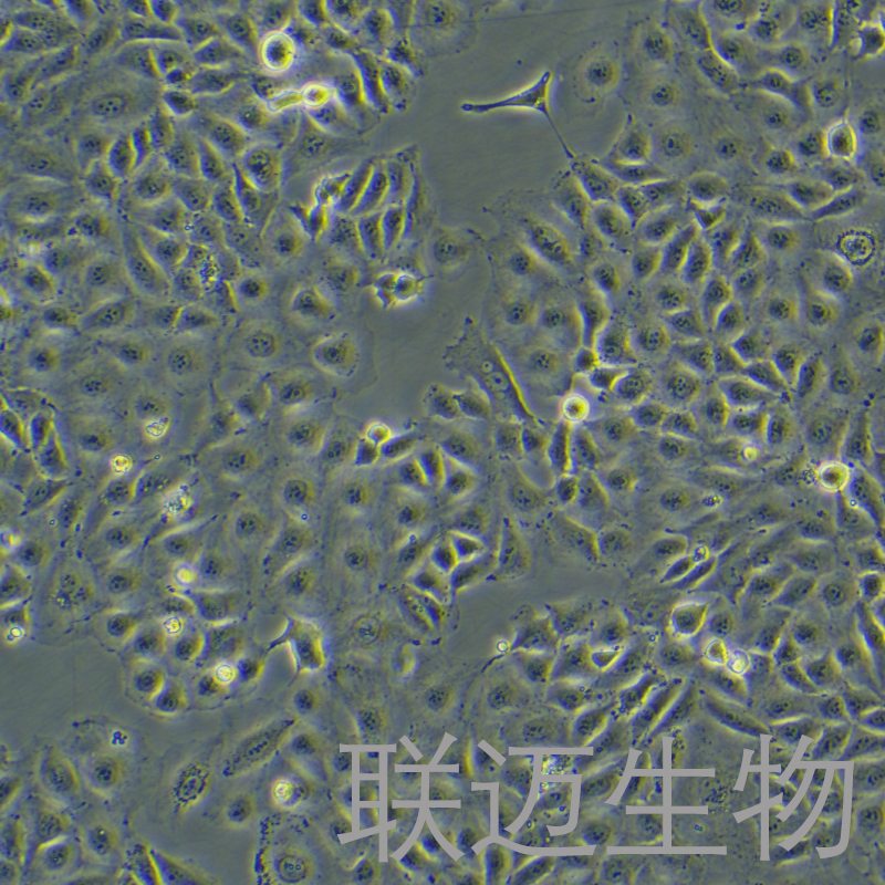 ECV304细胞（血管内皮细胞）LM8C0822