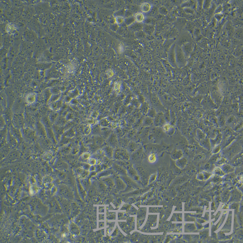 TU 686细胞（喉癌细胞）LM8C0857