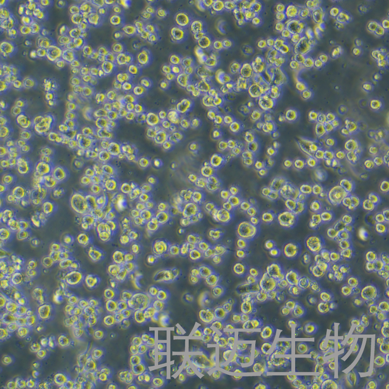 H22-luc细胞（小鼠肝癌细胞标记）LM8C0341-L