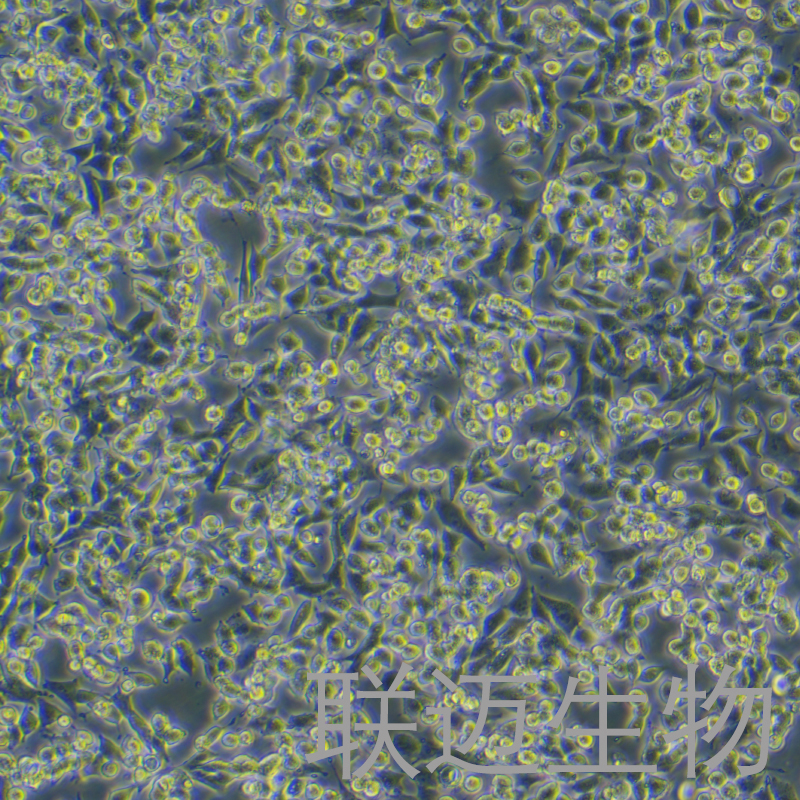 SNU-398细胞（肝癌细胞）LM8C0943