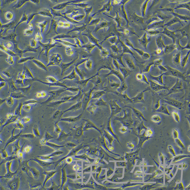 hRMECs细胞（视网膜微血管内皮细胞）LM8C0871