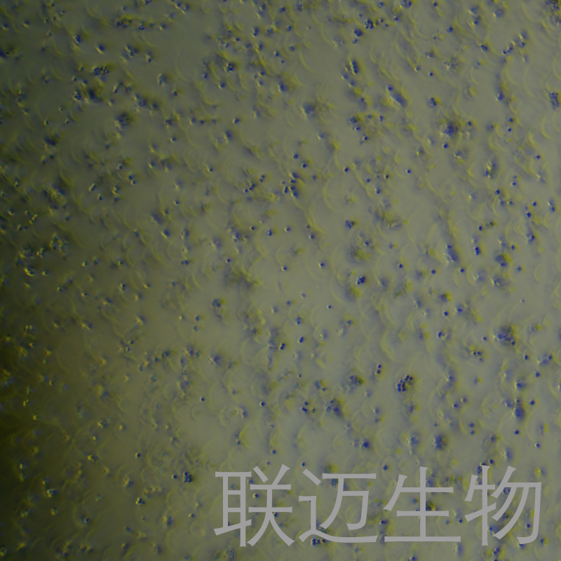 Nalm-6细胞（淋巴白血病细胞）LM8C0906