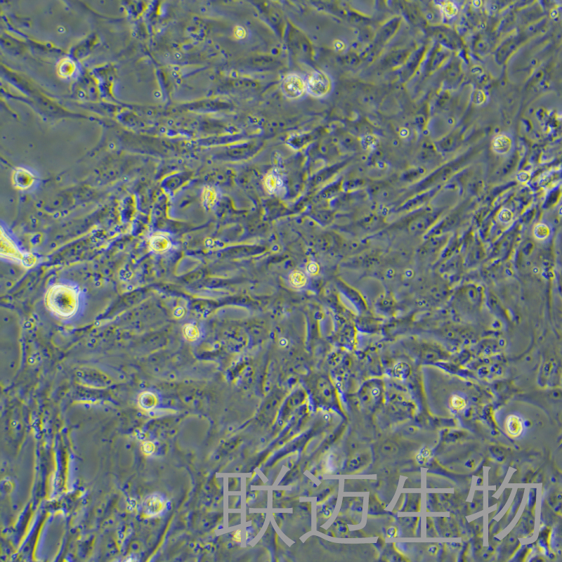 sNF96.2细胞（雪旺细胞(神经纤维瘤病1型)）LM8C0888