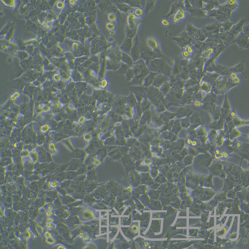 GL261-LUC细胞（小鼠胶质瘤细胞带荧光素酶）LM8C0866-L