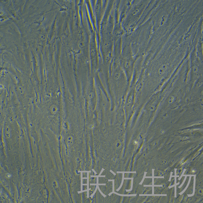 HPASMC细胞（肺动脉平滑肌细胞）LM8C0894