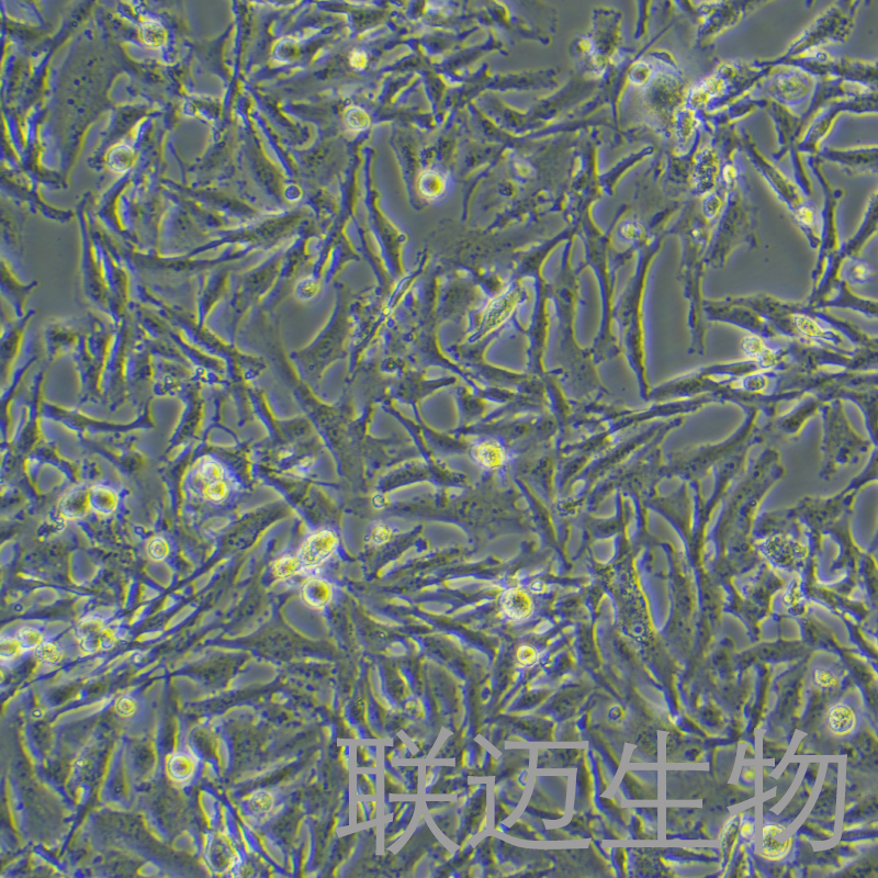 U251-GFP细胞（神经胶质细胞瘤细胞带绿色荧光）LM8C1081-G