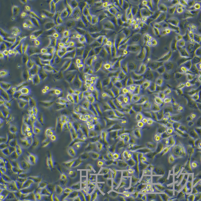 HMRSV5细胞（腹膜间皮细胞）LM8C0882