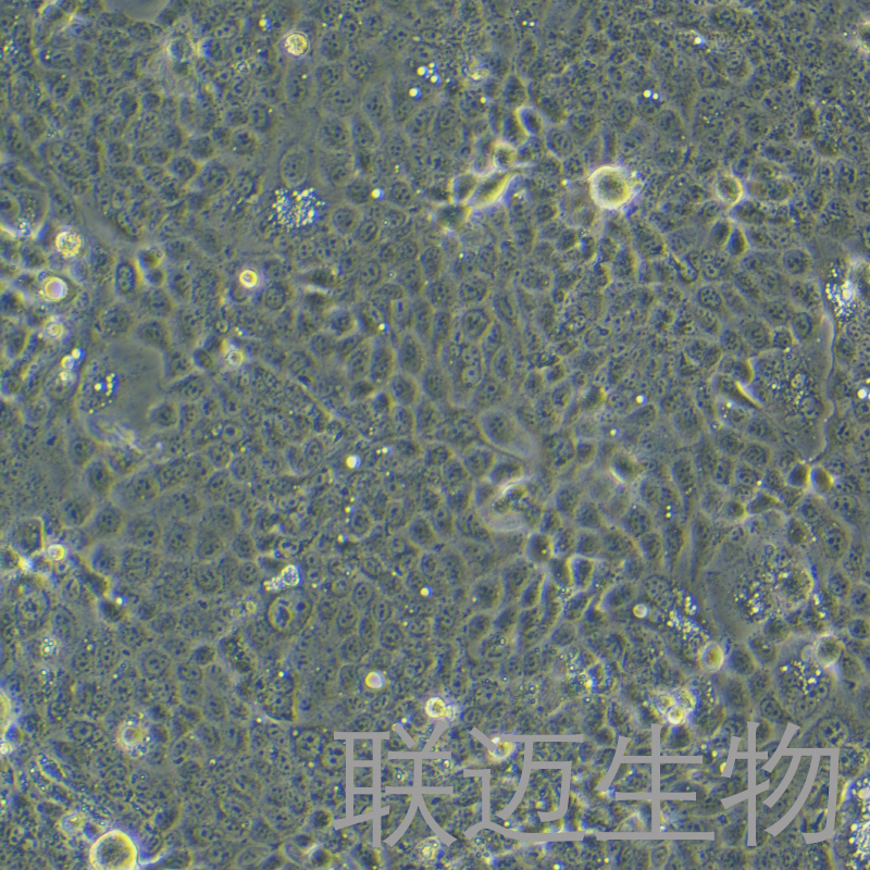 OE-33细胞（食管腺癌细胞）LM8C0934