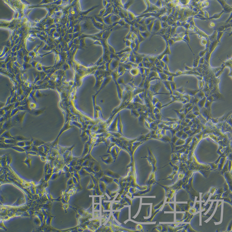 HET-1A细胞（食管上皮细胞）LM8C0917