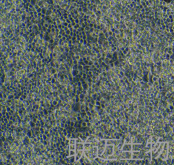 COV434细胞（卵巢癌细胞）LM8C0886