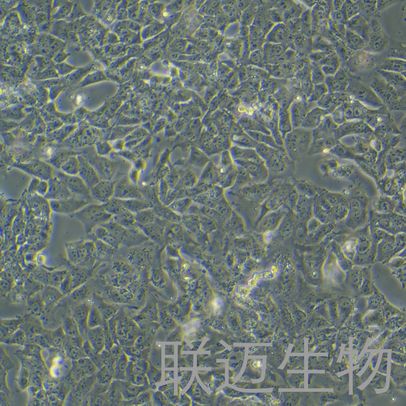 NTERA-2 cl.D1细胞（睾丸癌细胞）LM8C0936