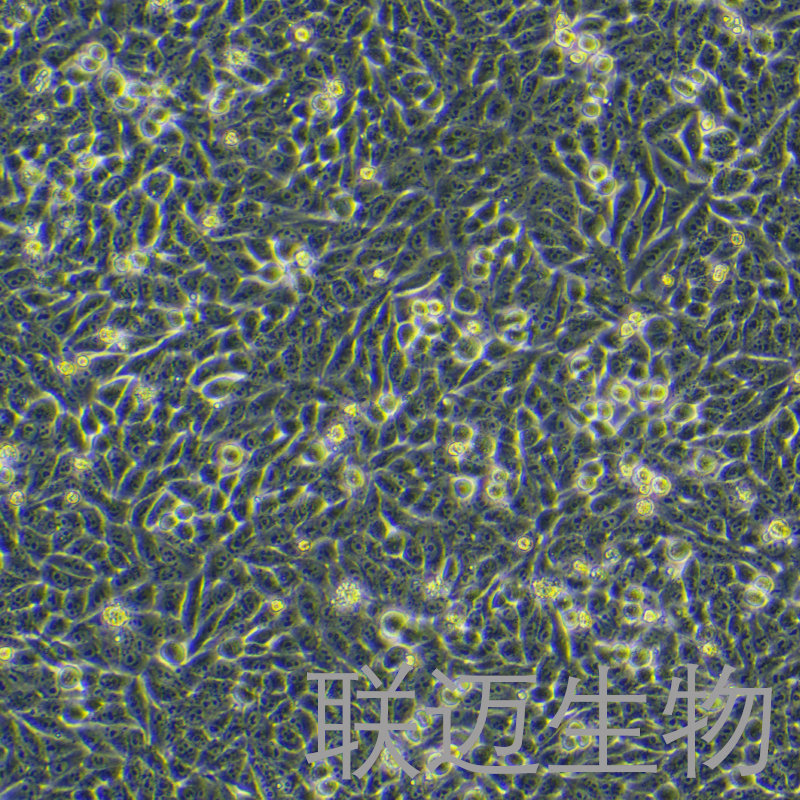 VX2细胞（兔间变表皮鳞癌瘤株）LM8C0938