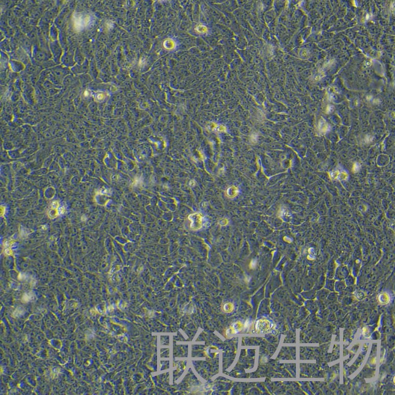 WSU-HN30细胞（口腔鳞状细胞）LM8C0959