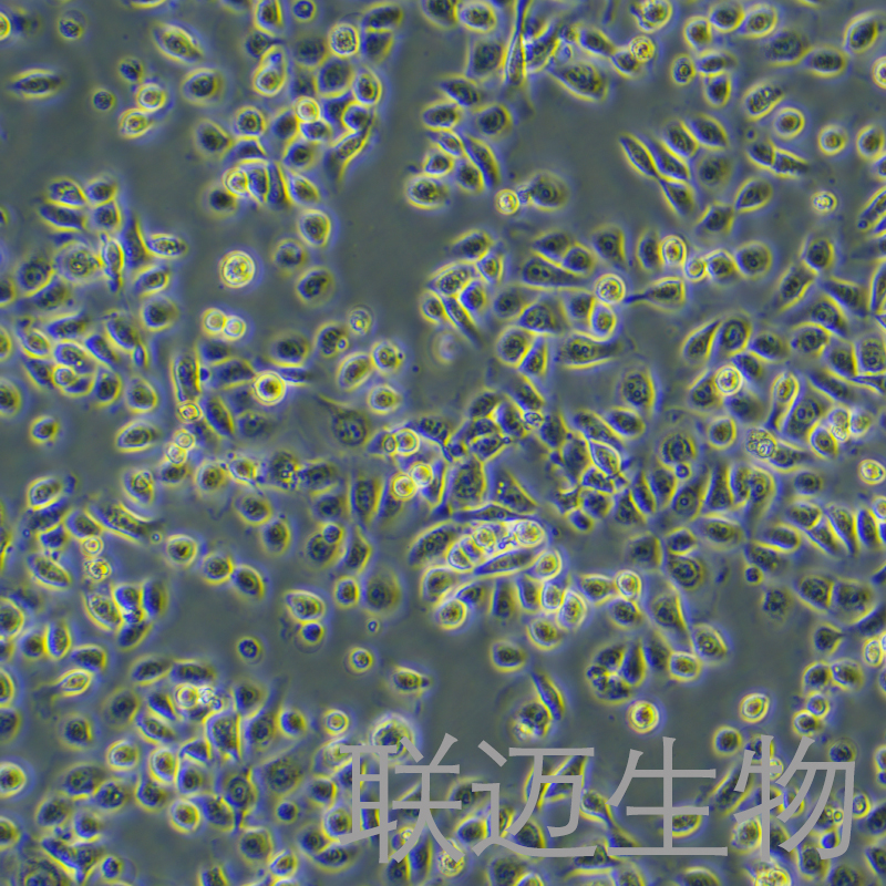 heec细胞（子宫内膜上皮细胞）LM8C0954