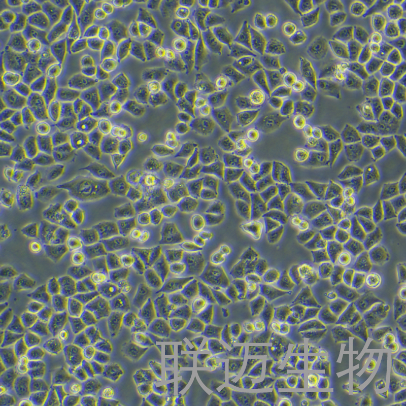 IOSE-80细胞（正常卵巢上皮细胞）LM8C0949