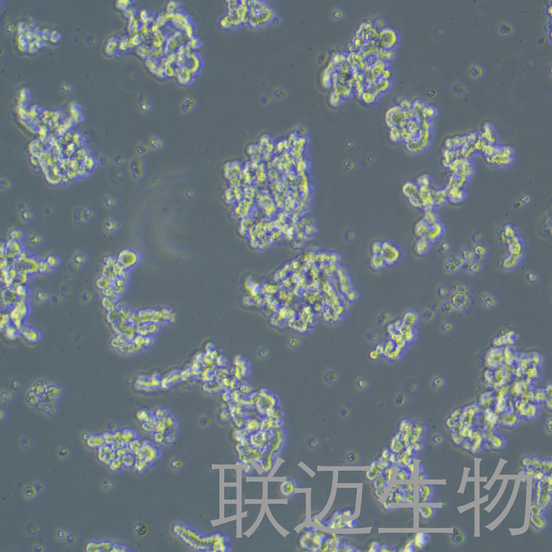 Y79细胞（视网膜母细胞瘤） LM8C0961