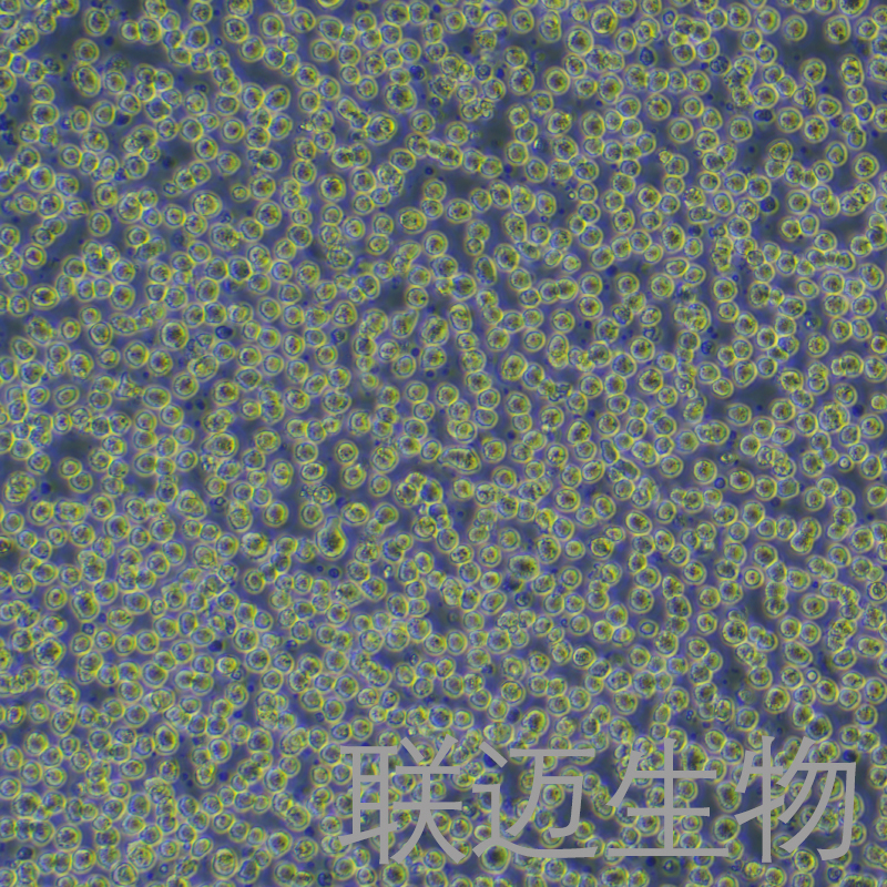 Karpas-299细胞（间变性大细胞淋巴瘤细胞）LM8C0972