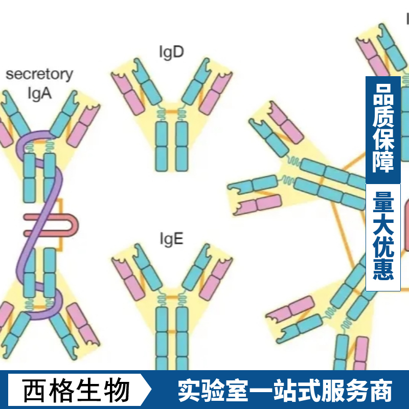 钙调蛋白激酶激酶β抗体