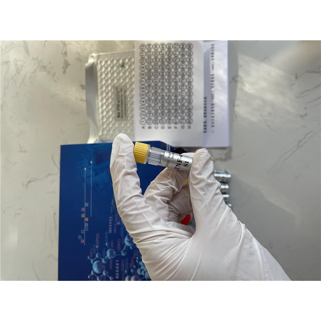 人抗Scl-70IgG抗体(Scl-70 IgG)ELISA试剂盒