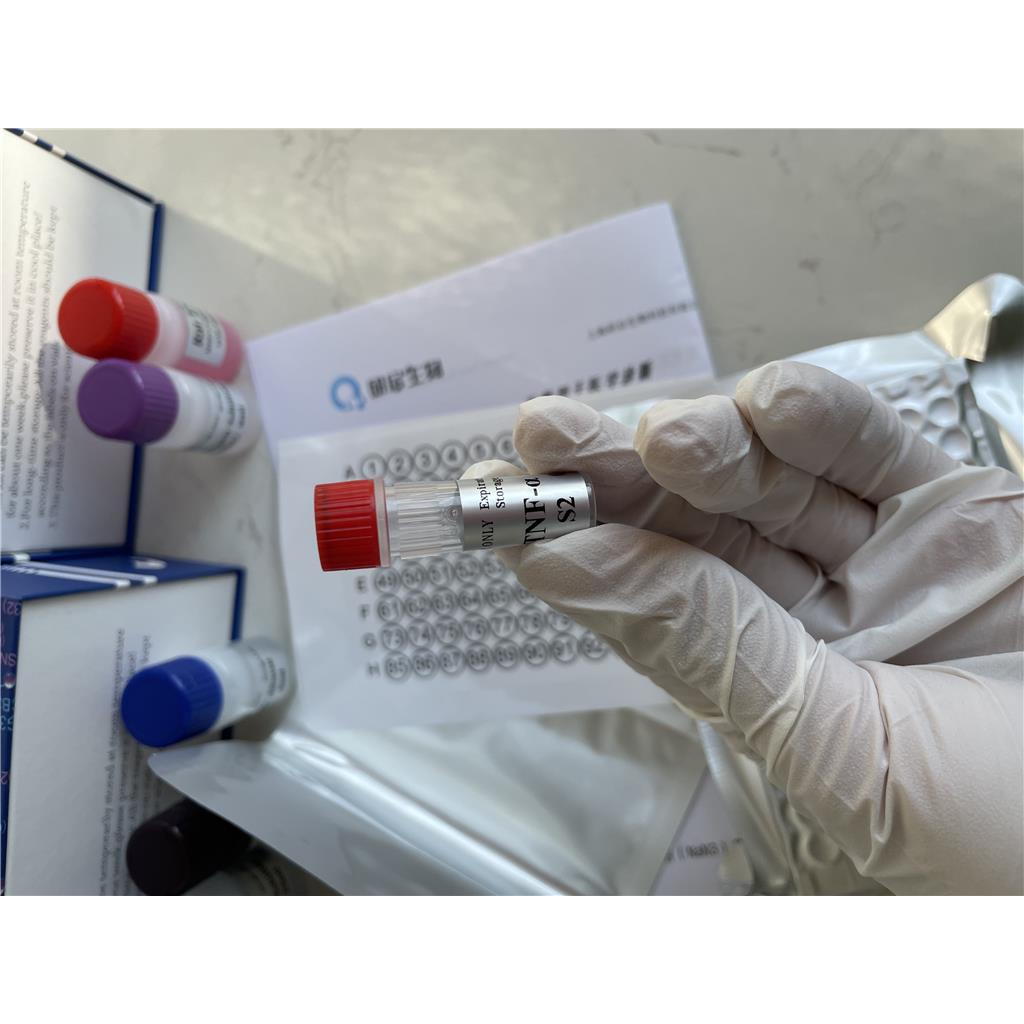 人抗Scl-70IgG抗体(Scl-70 IgG)ELISA试剂盒