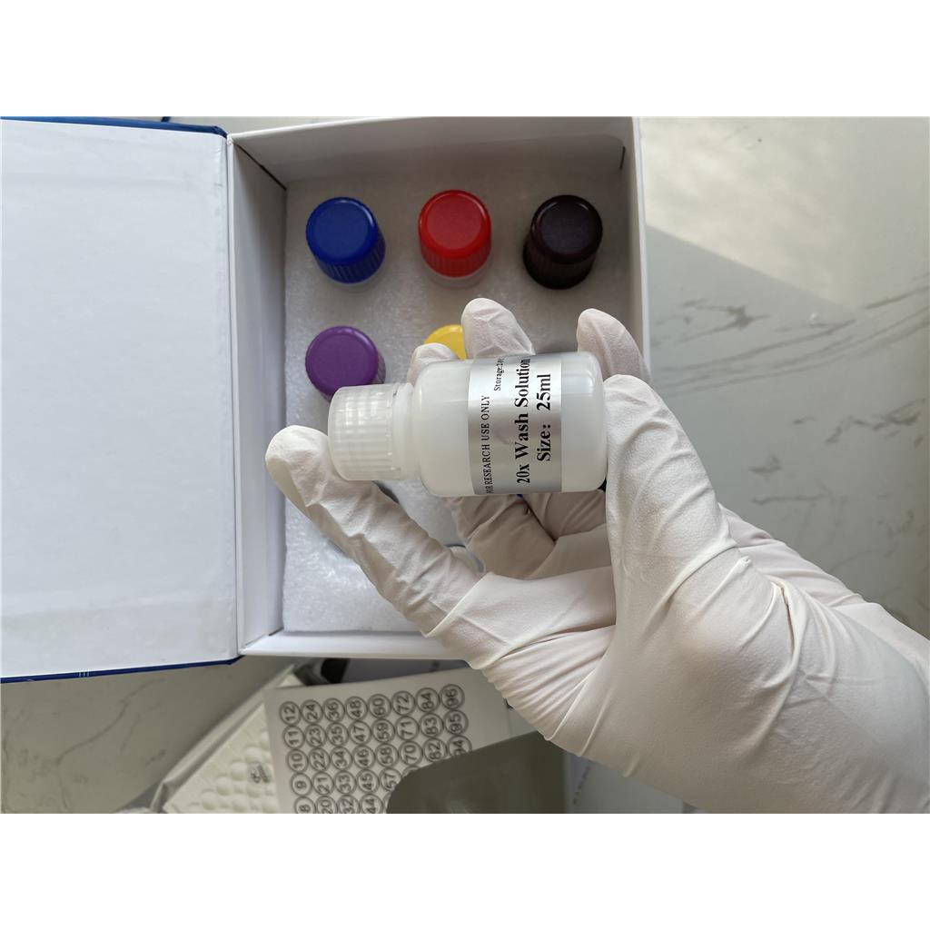 人抗SSA IgG抗体(SSA IgG)ELISA试剂盒