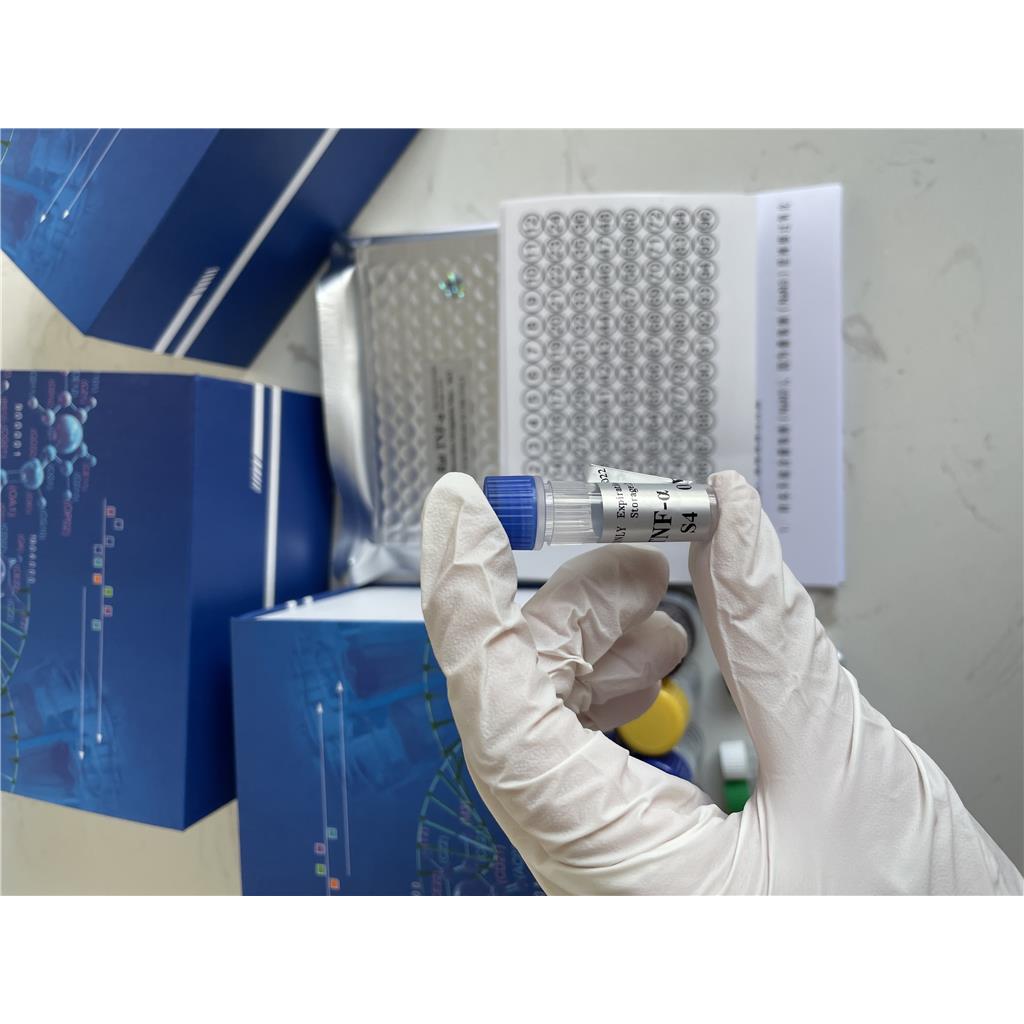 人抗SSA IgG抗体(SSA IgG)ELISA试剂盒