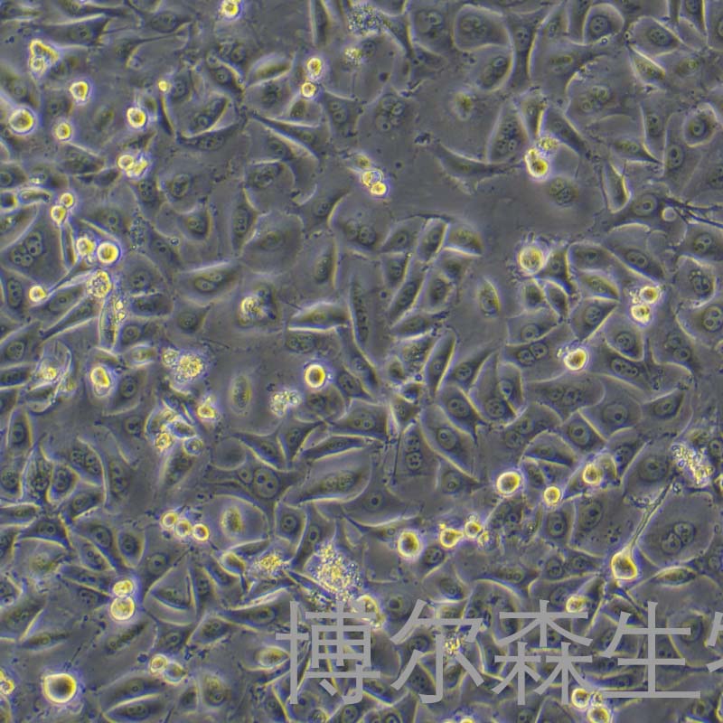 MKN1细胞（人胃癌细胞）