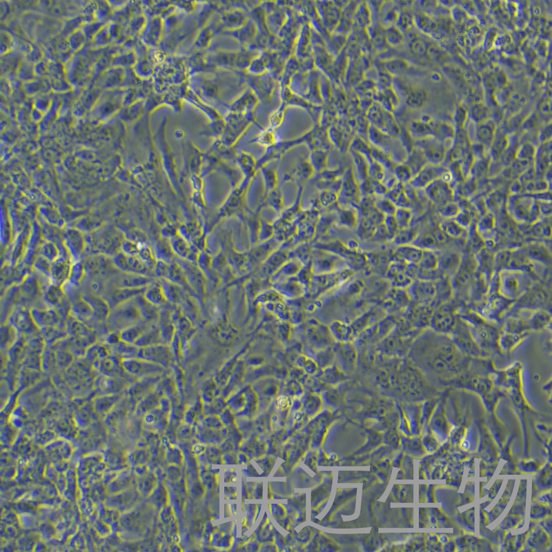 bEnd.5细胞（小鼠Balb c脑内皮瘤）LM8C1025