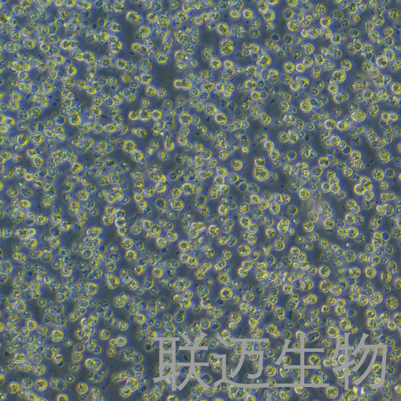 AKATA细胞（EBV转化淋巴细胞系）LM8C1020