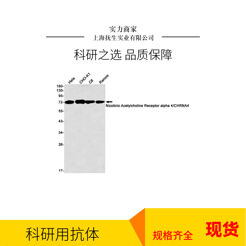 p53结合蛋白1抗体