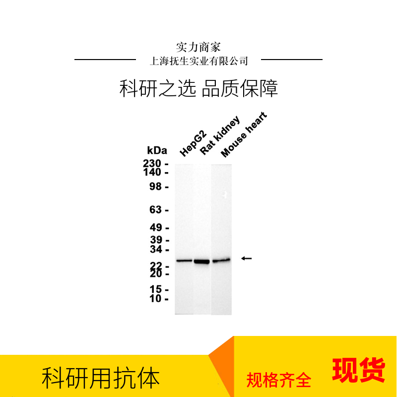 PRDM锌指转录因子PRDM16抗体