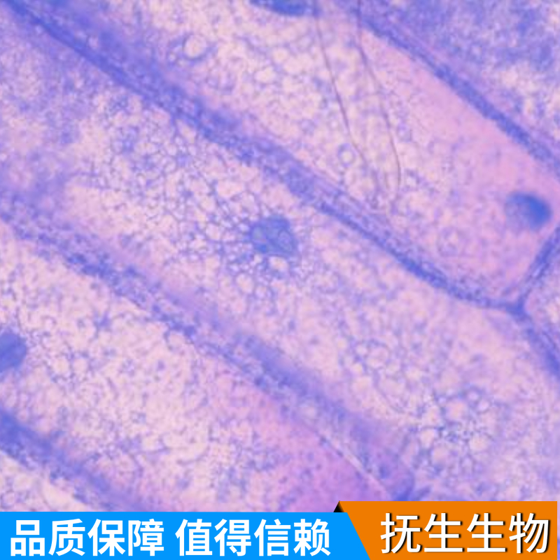 人口腔鳞状细胞；WSU-HN30 (STR)