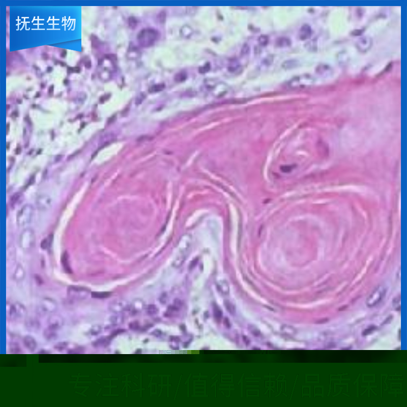 人胚肾细胞；HEK-293T/17