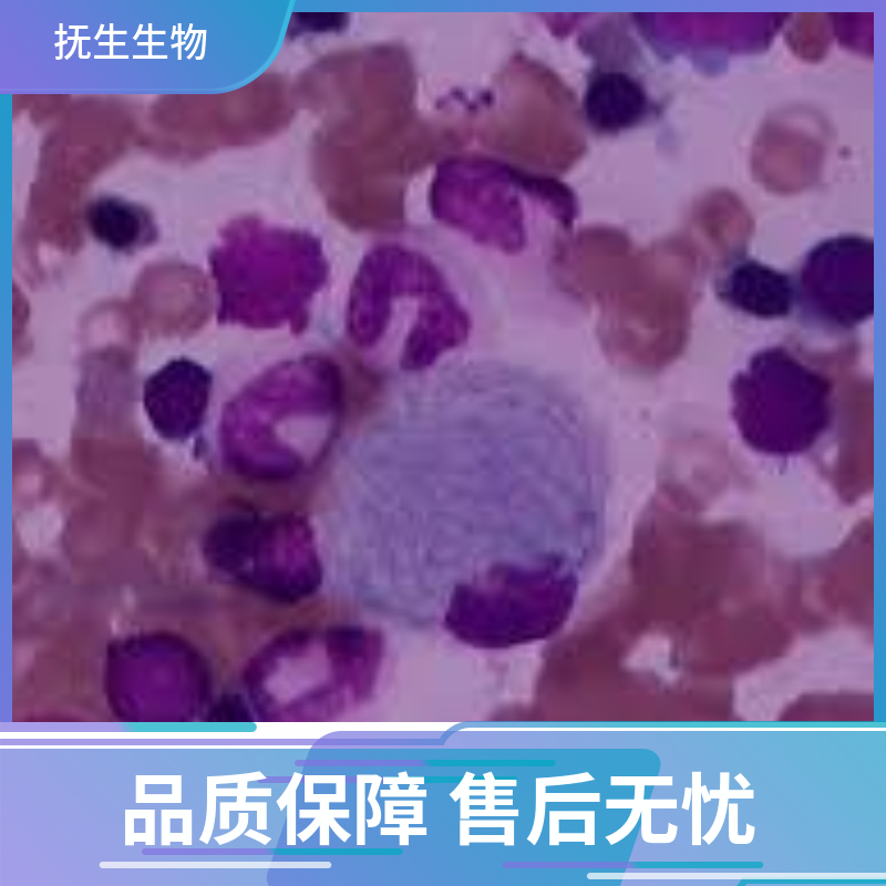 人卵巢癌细胞+LUC；SK-OV-3+LUC