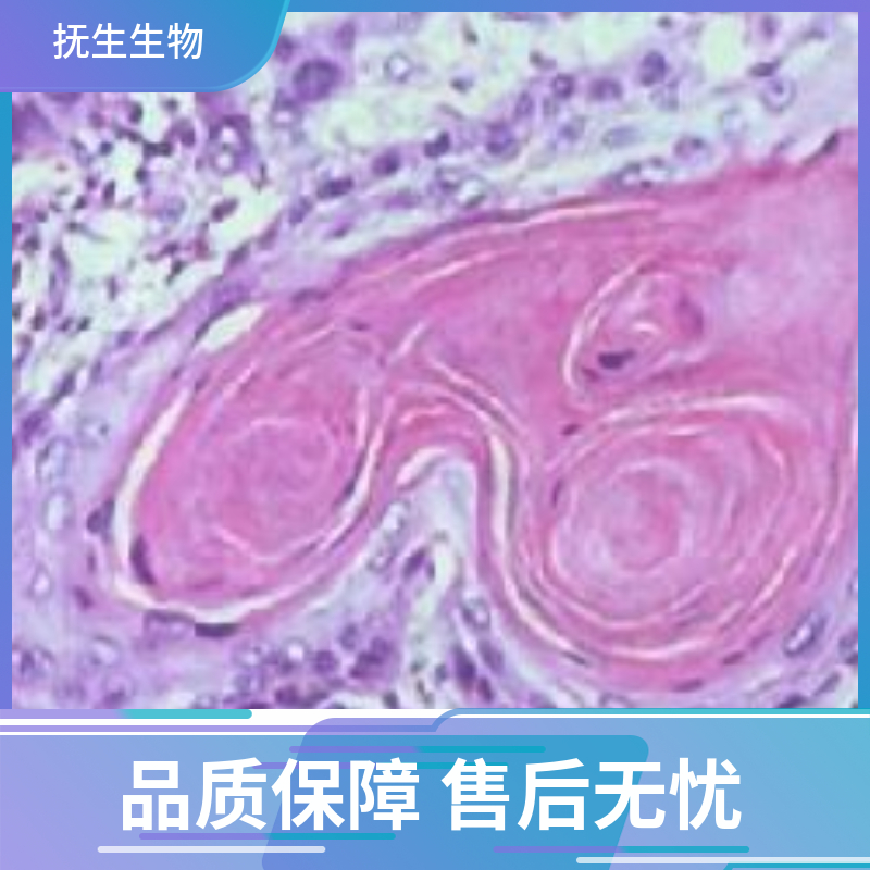 人非小细胞肺癌细胞+LUC；HCC827+LUC